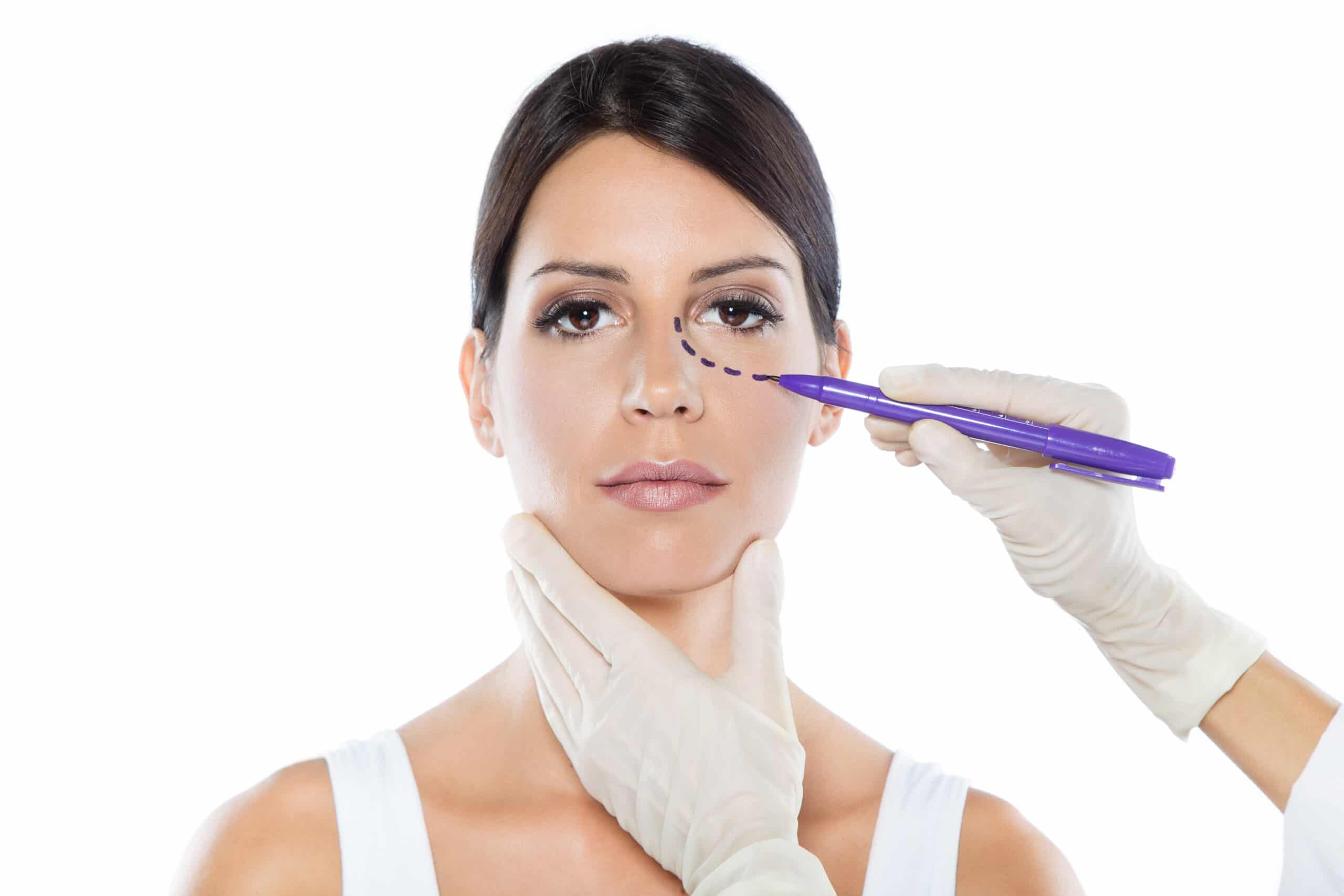 Plastic surgeon drawing dashed lines on her patient's face.